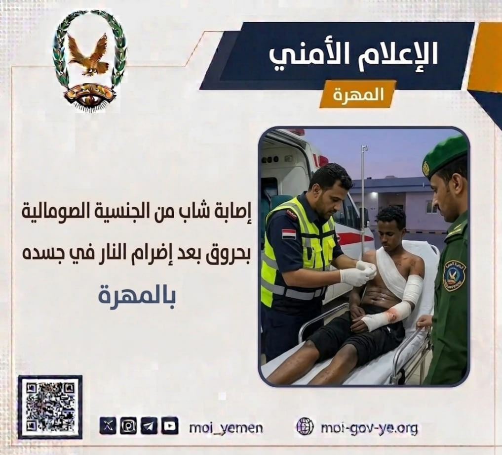 إصابة شاب من الجنسية الصومالية بحروق بعد إضرام النار في جسده بالمهرة Image